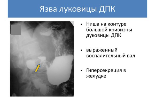 Кракен как попасть